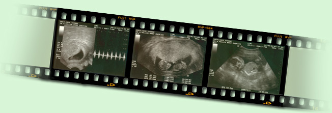 nun erkennt man doch was